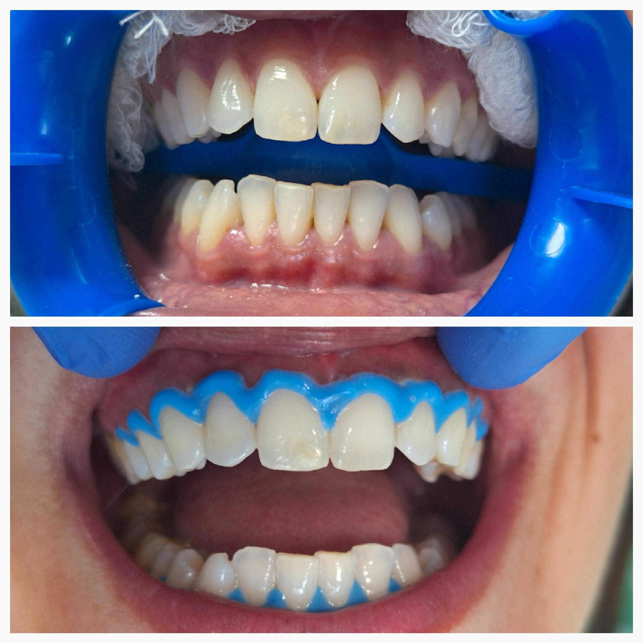 Opća stomatološka ordinacija IN-DENT