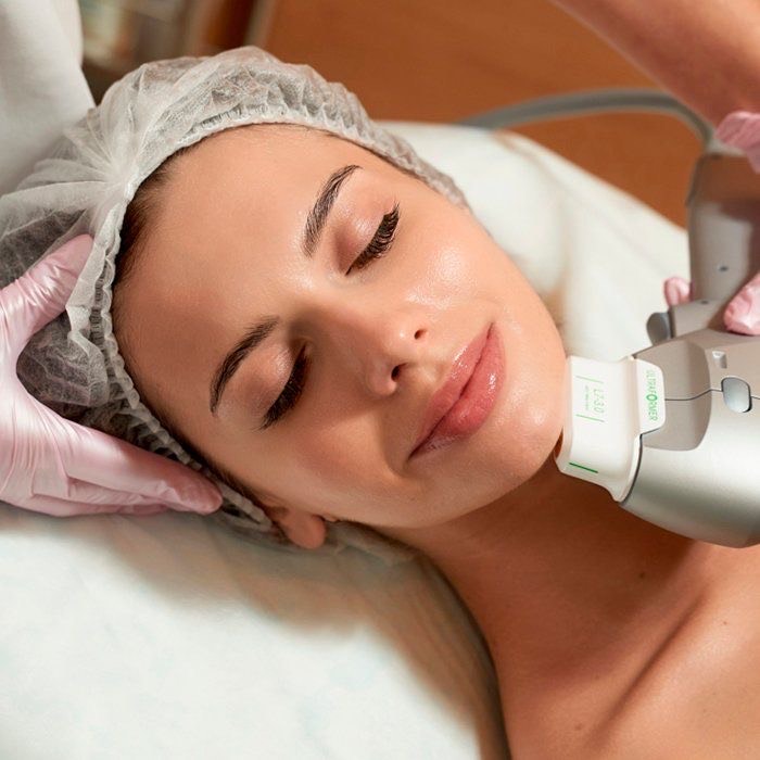 HIFU tretman lica i vrata